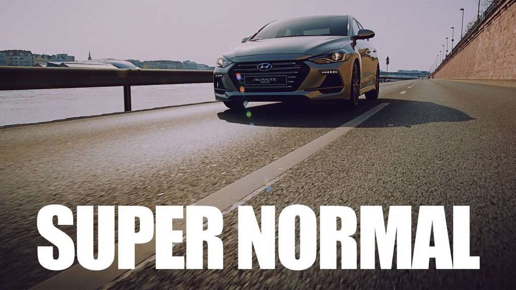 Video: Hyundai Elantra Sport 2017 Video: Hyundai Elantra Sport 2017